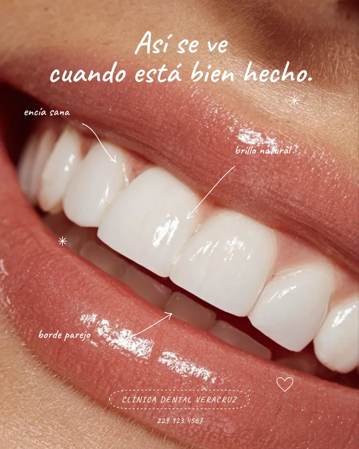 Así se ve cuando está bien hecho