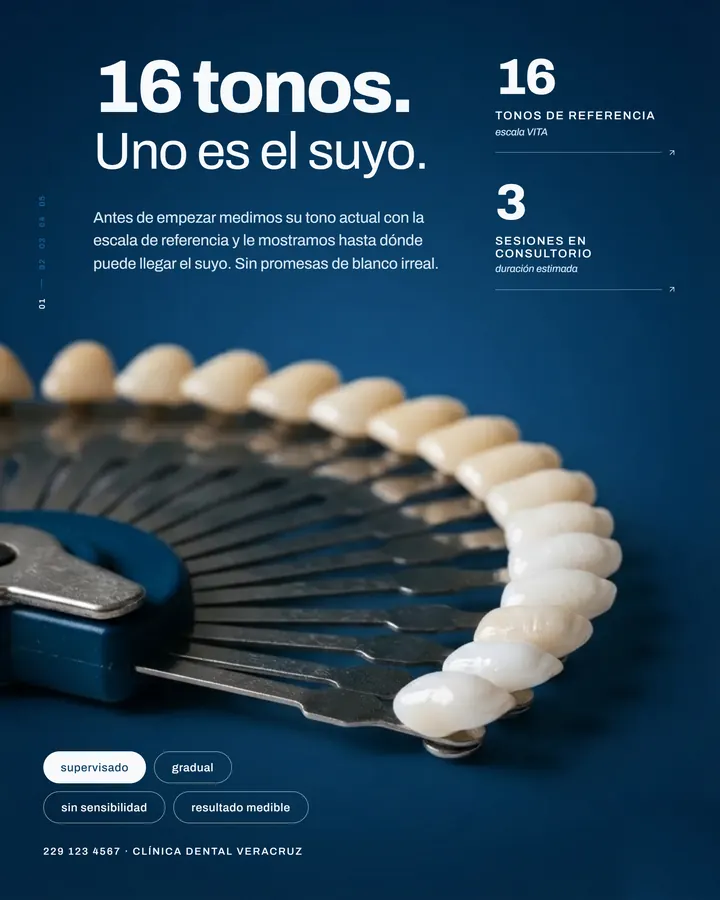 16 tonos