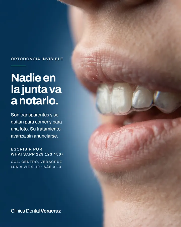 Nadie en la junta va a notarlo